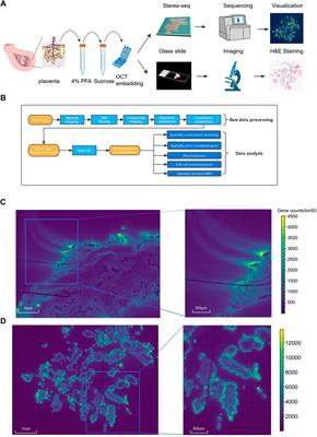 Resolving the gene expression maps of human first-trimester chorionic villi with spatial transcriptome